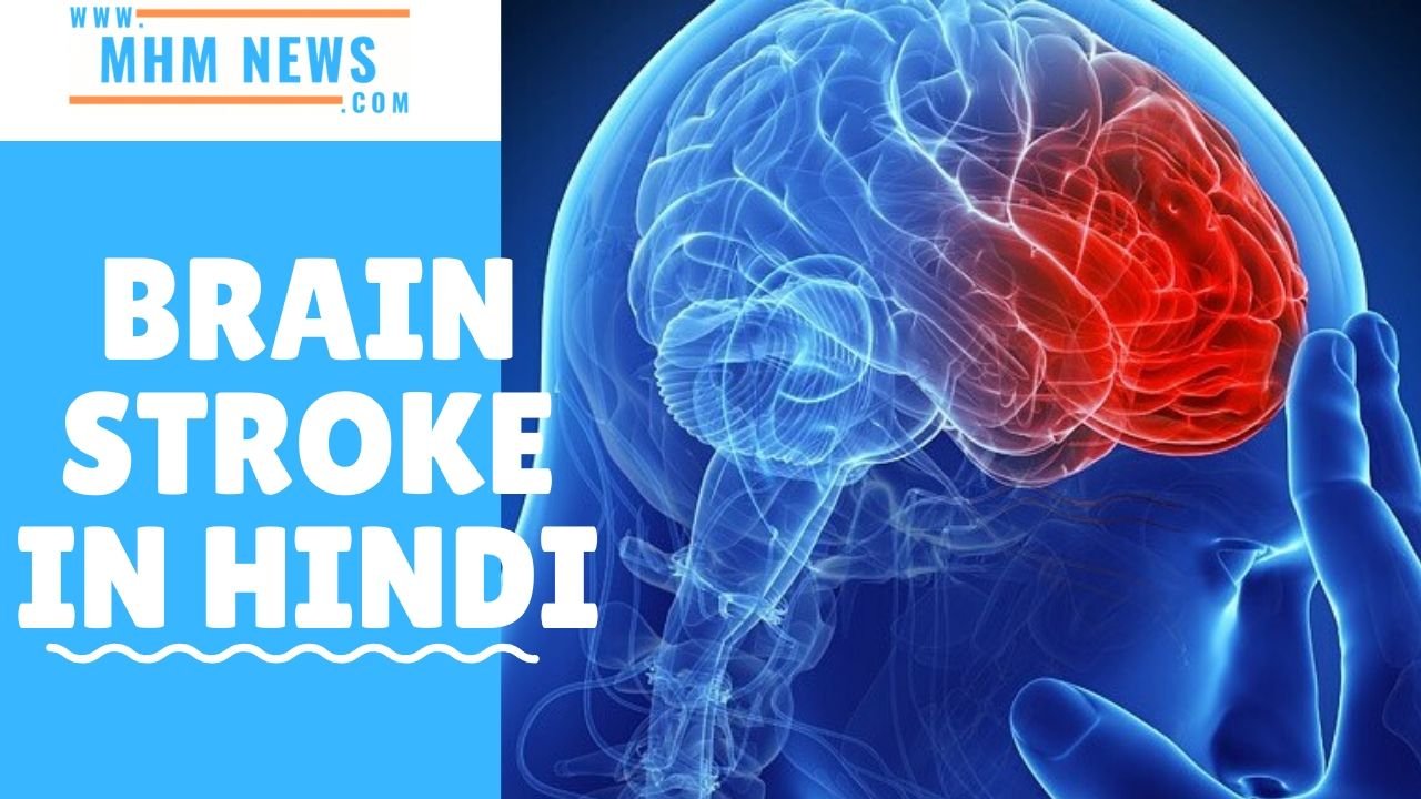 brain stroke in hindi symptoms meaning treatment ,dry stroke