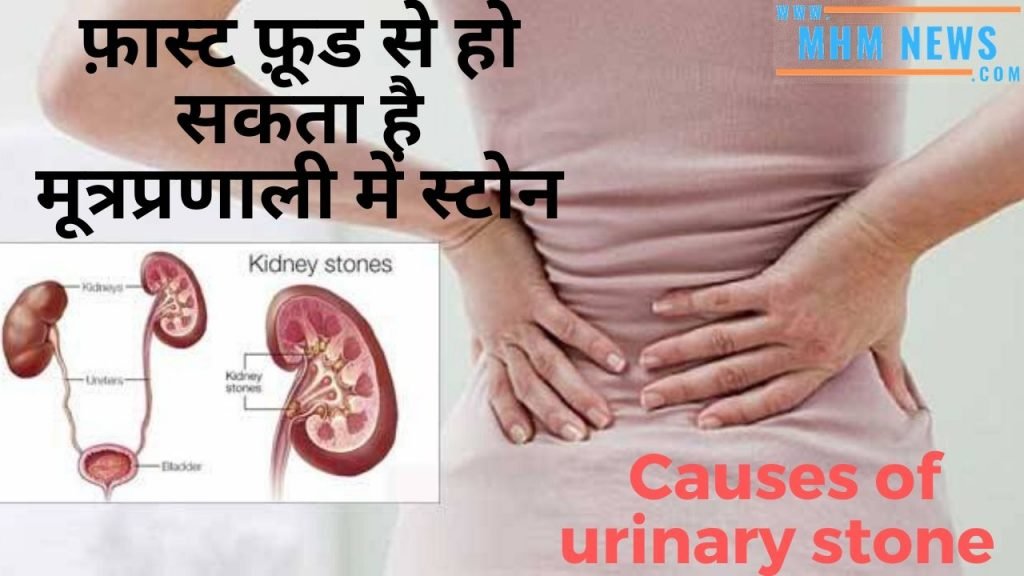 Causes of urinary stone in Hindi 